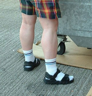 The Socks and Sandals scandal