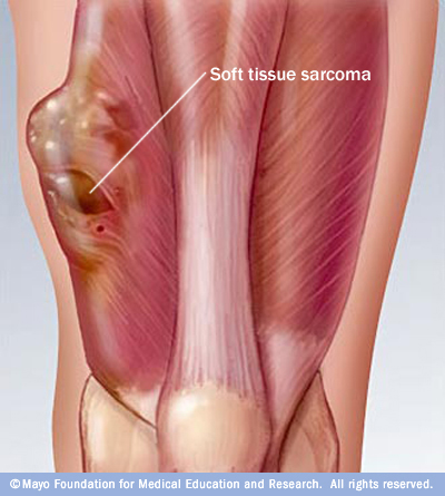 soft tissues of your body